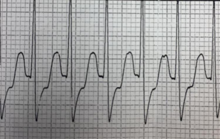 16832100_394044320958056_1096171373219738848_n
